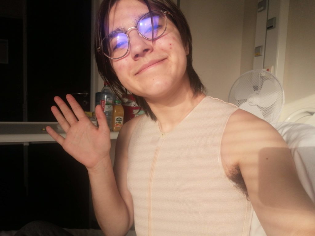 Selfie au soleil dans mon lit d'hôpital. Je porte une brassière couleur peau qui couvre tout mon torse. Mon torse est plat et on peut voir un petit peu le relief d'un pansement dessous.